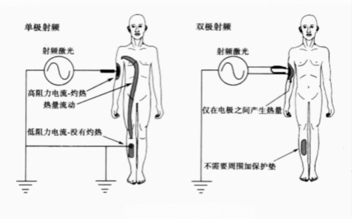 射頻美容儀,美容院美容設備,家用美容儀