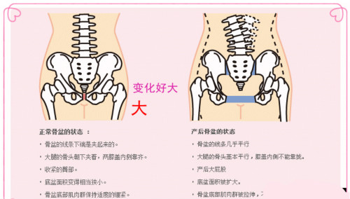 產(chǎn)后修復(fù)的項(xiàng)目有哪些？最好用是什么樣的產(chǎn)后修復(fù)儀器？