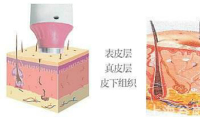 什么叫RF射頻技術(shù)？