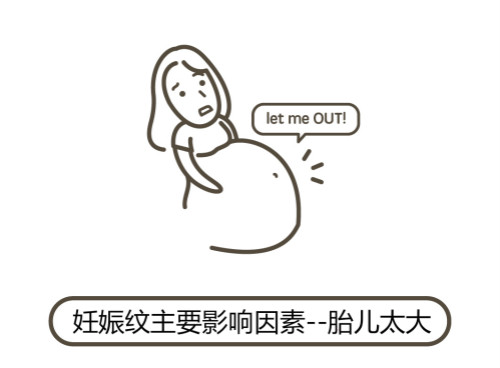 一文秒懂！妊娠紋肥胖紋保養(yǎng)、治療及預(yù)防全攻略