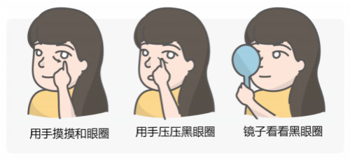 區(qū)分黑眼圈！黑眼圈的成因、分類、預(yù)防與治療全攻略