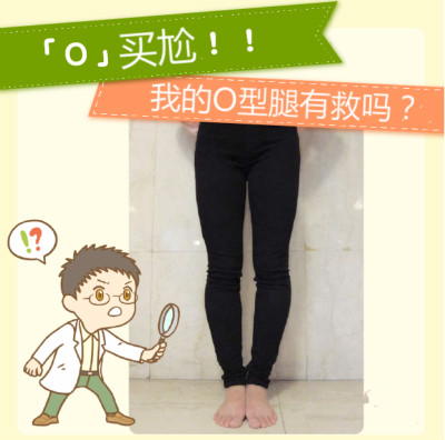 ”O(jiān)” 買尬～四招搶救 O 型腿！
