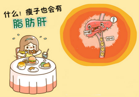 什么！瘦子也會(huì)有「脂肪肝」？