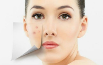原來痘痘長不停是「枕頭」害的？5個你可能不知道的護膚秘訣