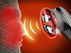 射頻美容儀的作用原理是怎么樣的？具體分成哪幾種？