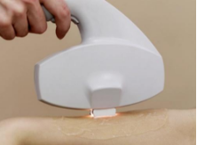 脫毛儀脫毛會(huì)傷害血管嗎？真相令人吃驚