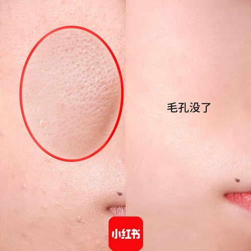 美容儀廠家告訴您收斂毛孔的小秘密！