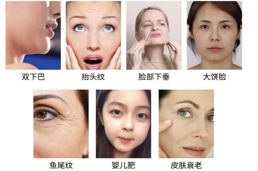美容儀廠家教您怎么預(yù)防臉上長斑，要注意什么?