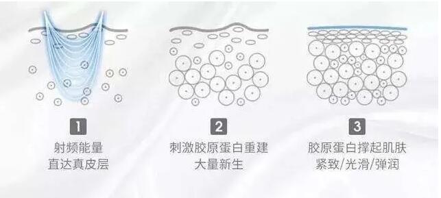 家用射頻美容儀怎么選？小心交了智商稅！