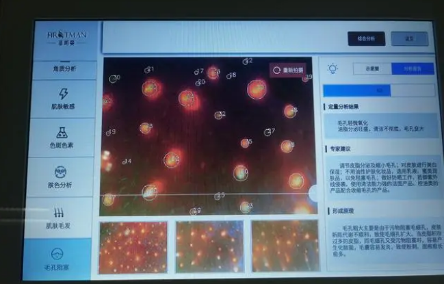皮膚檢測儀對于美容院來說有哪些作用？